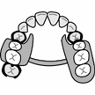 入れ歯の図